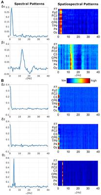 Blind Visualization of Task-Related Networks From Visual Oddball Simultaneous EEG-fMRI Data: Spectral or Spatiospectral Model?